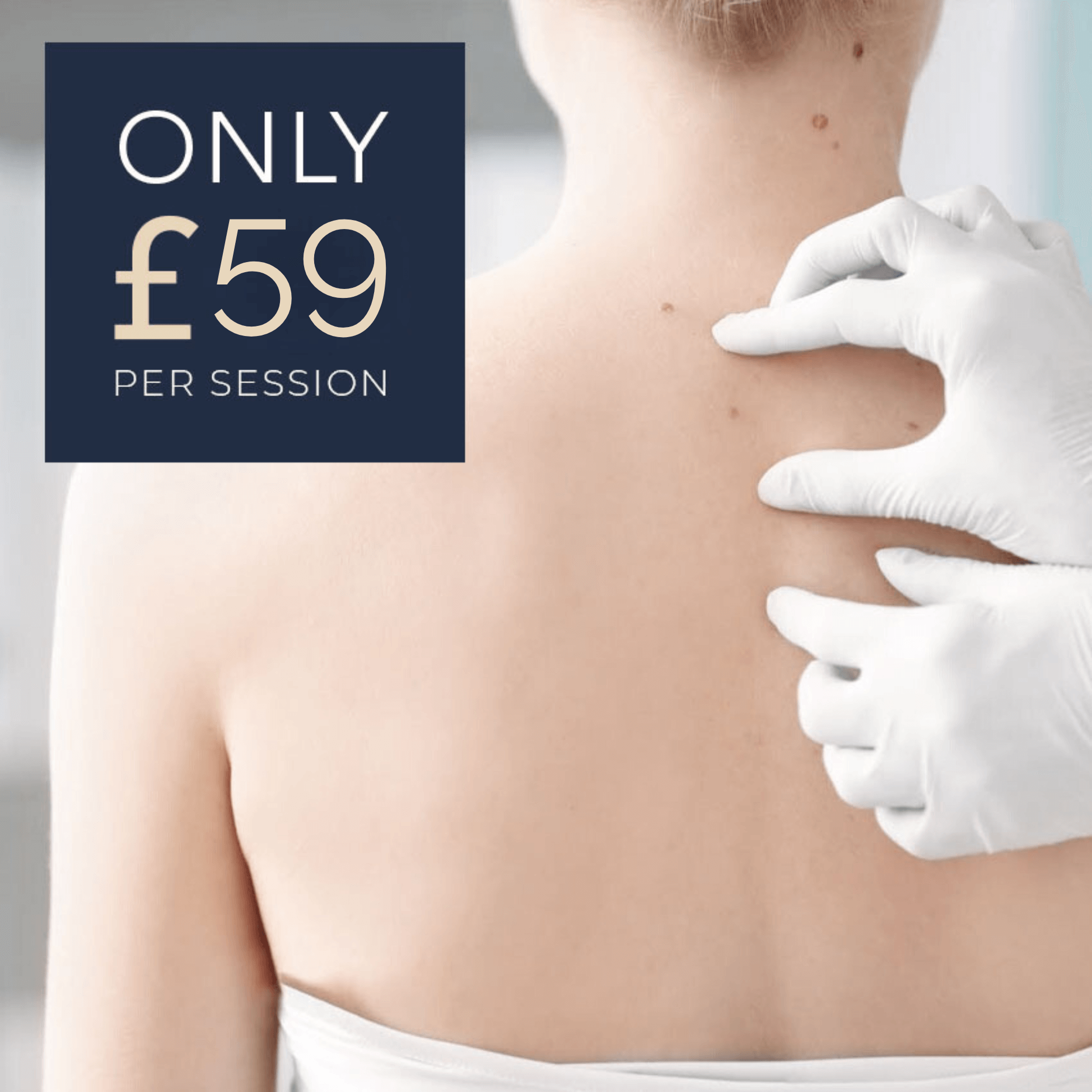 Skin Tag Removal Maidstone Kent